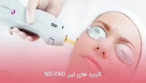 کاربرد های لیزر ND:YAG