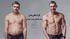 مرکز فرم دهی بدن در تهران | باسن | صورت | تخفیف ویژه