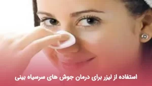 استفاده از لیزر برای درمان جوش های سرسیاه بینی