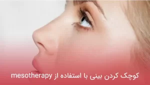 کوچک کردن بینی با استفاده از mesotherapy
