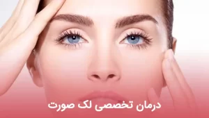 درمان تخصصی لک صورت