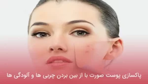 پاکسازی پوست صورت با از بین بردن چربی ها و آلودگی ها